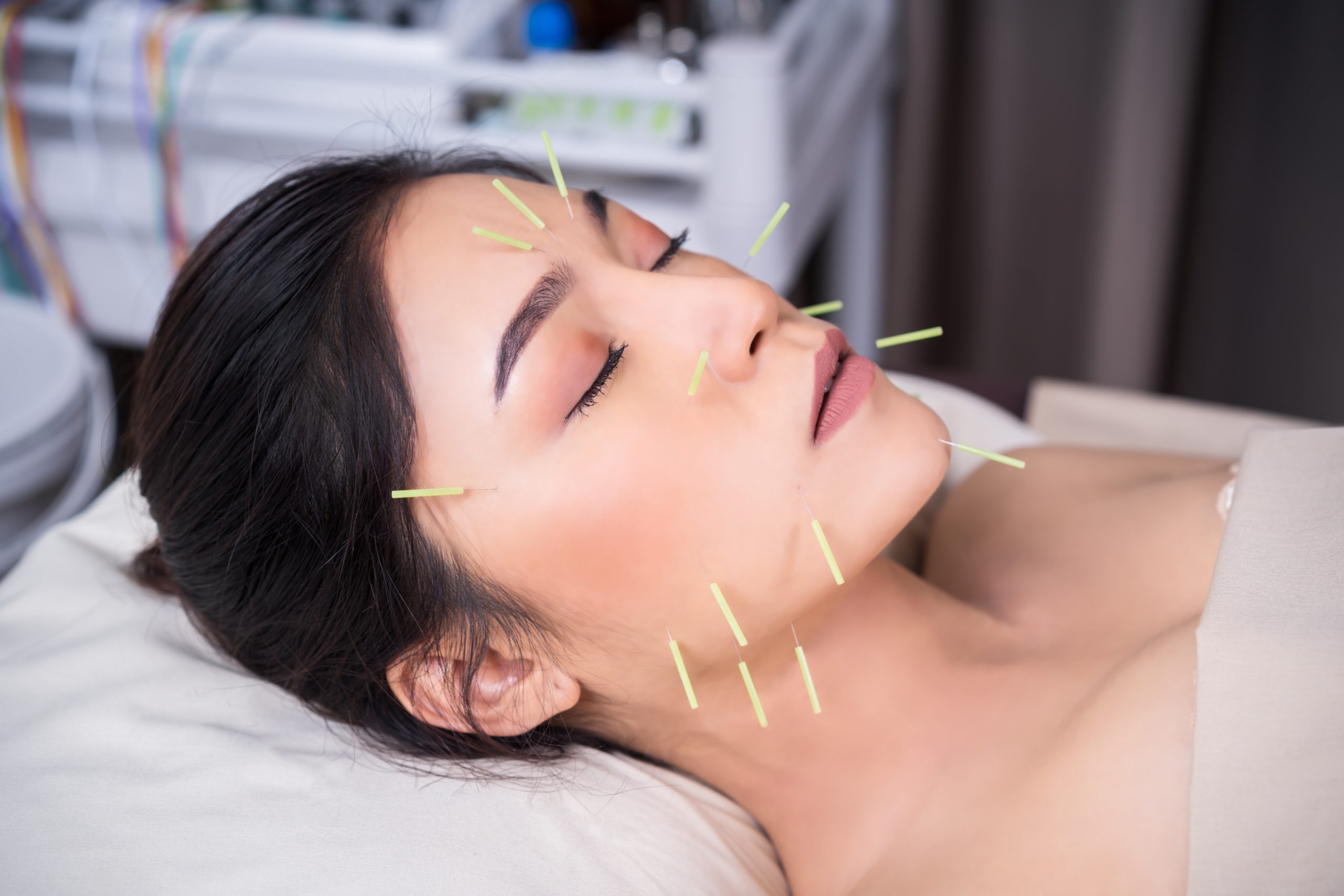 Rejuvenate Your Skin Naturally with the Wonders of Facial Acupuncture and Natural Techniques